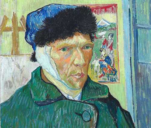 Self-portrait with Injured Ear 